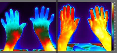 Too Hot Too Cold Or Just Right Thermal Imaging In Care Homes The