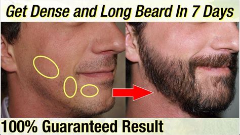 how to grow beard faster all you need infos