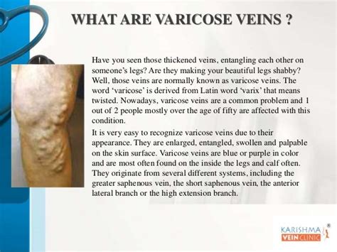 Varicose Vein Treatment Clinic In Pune Karishma Vein Clinic