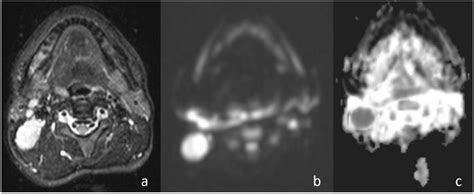 JCM Free Full Text The Role Of Diffusion Weighted Magnetic Resonance Imaging In The