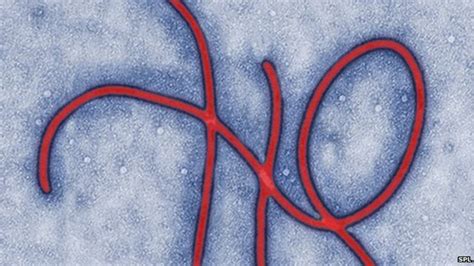 Uk Ebola Medics Under Investigation Bbc News