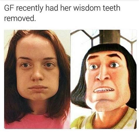 29 Memes For Today 79 Funnyfoto Funny Pictures Can T Stop Laughing Af Memes Wisdom Teeth