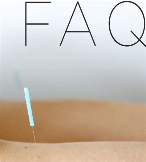 Acupuncture — Pyndus Acupuncture And Wellness