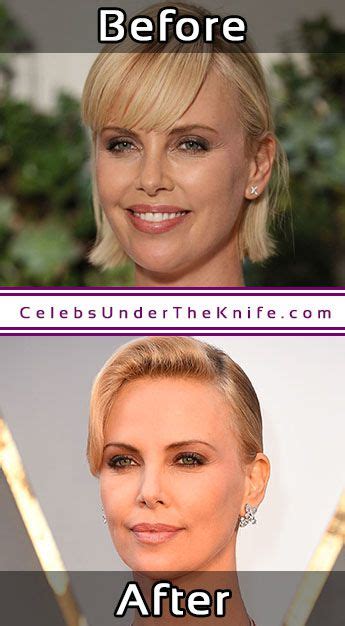 Charlize Theron Nose Job Photos Before After Plastic Surgery