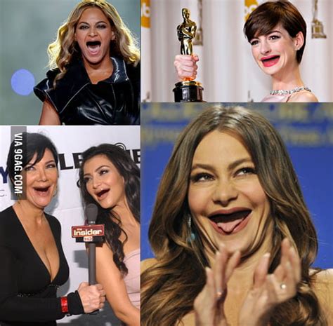 Celebrities Without Teeth Gag
