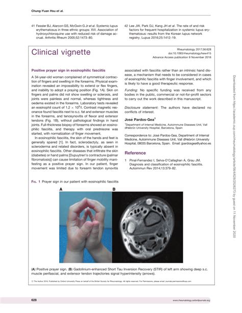 Pdf Positive Prayer Sign In Eosinophilic Fasciitis