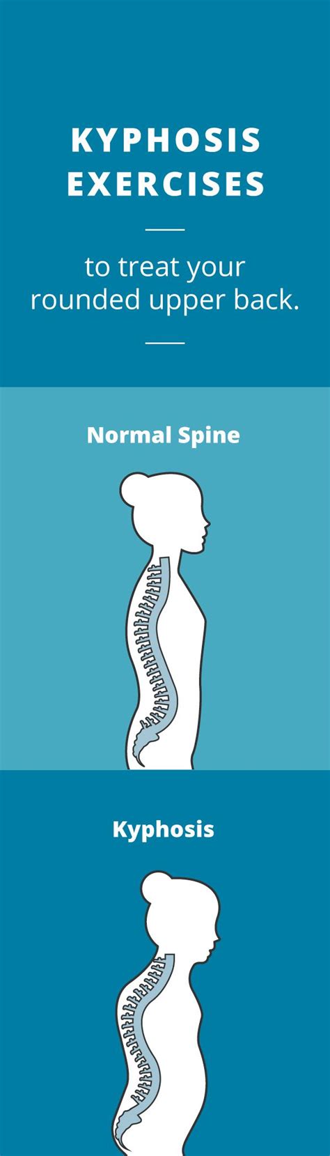 Kyphosis Exercises Treat A Rounded Upper Back Kyphosis Exercises