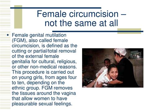 Ppt Male Circumcision Powerpoint Presentation Free Download Id6657894