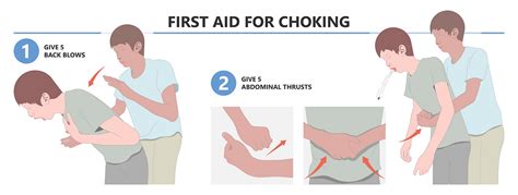 Life Saving First Aid Techniques For Choking Victims