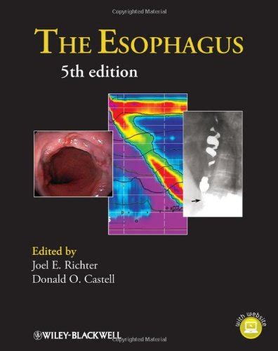 Pain In Esophagus Pain In Pain In Esophagus Pain Inside Knee Cap