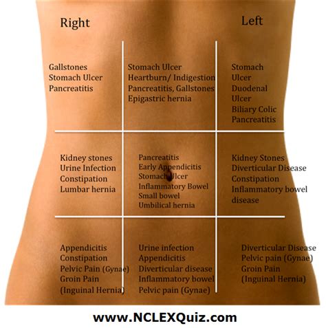 Know Your Stomach Pain Location Cheat Sheet Nclex Quiz