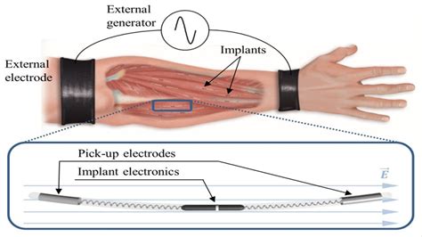 The Human Body As An Electrical Conductor A New Method Of Wireless