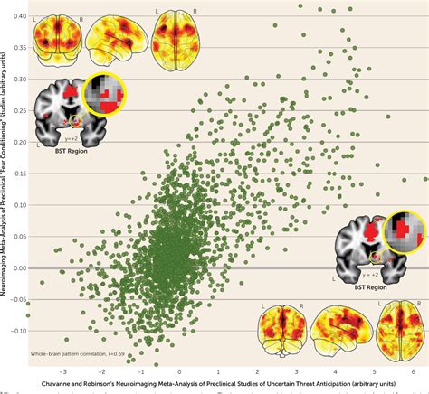 Figure 1 From Two Decades Of Anxiety Neuroimaging Research New