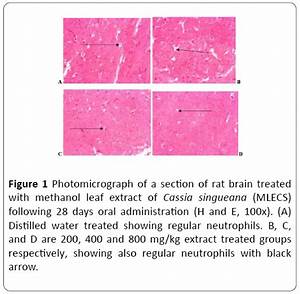 Acute and Sub-chronic Toxicity Studies of Methanol Leaf Extract of Cassia singueana F. (Fresen ...  Brain Tumor Herbal Medicine