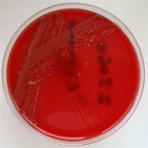 Listeria monocytogenes is the species of pathogenic bacteria that causes the infection listeriosis. File:Listeria monocytogenes - Columbia Horse Blood Agar ...