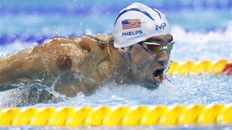 Cupping saleh #حجامة_صالح a way to identify cupping therapy points by employing thermal changes examination techniques to detect points associated with the. Michael Phelps cupping at the Rio Olympics: Why this ...