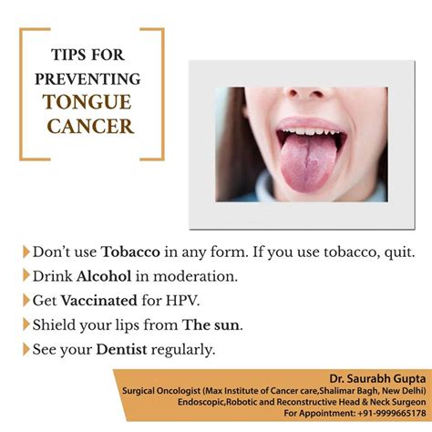 Dr Saurabh Gupta Oncologist Tips For Preventing Tongue Cancer