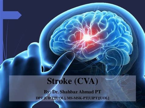 Stroke Cva Cva Cerebrovascular Accident Transient Ischemic Atta
