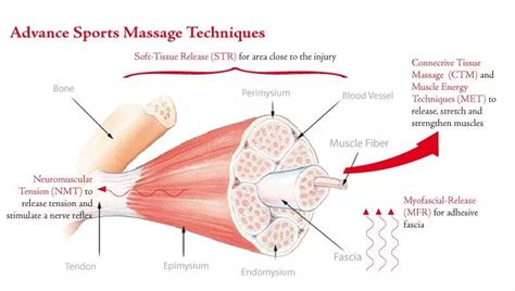 What Causes Delayed Onset Muscle Soreness Doms