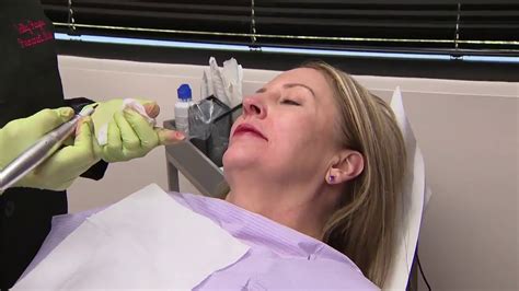 Sally Hayes Shows Us How She Applies Permanent Makeup For Your Lips 1