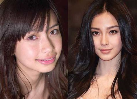 Angelababy Plastic Surgery Before And After Pictures 2020