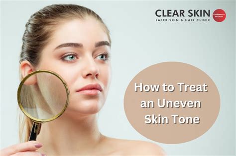 How To Treat An Uneven Skin Tone