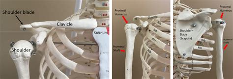 Proximal Humerus Fracture Broken Shoulder Orthopaedic Trauma