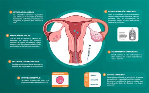 Fecundación in vitro Clínica de Reproducción Humana UV