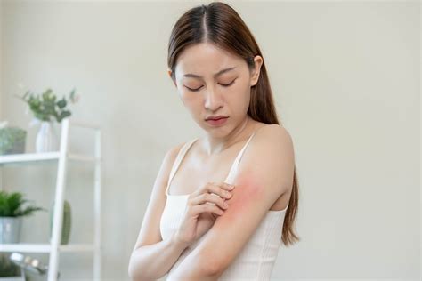 Dermatite Allergica Cause E Rimedi Naturali Tanta Salute The Best