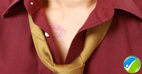 Are You Aware About Hickey And What Else To Know
