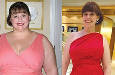 Kathryns Gastric Bypass Surgery Story