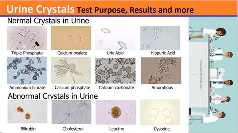 Why the ph test is performed. Urine Crystals Test Purpose, Procedure, Results and more ...