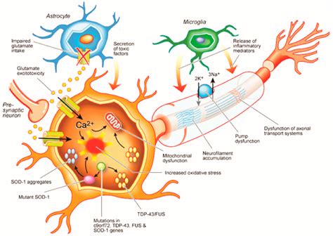 To the, at the, toward the (masculine plural). IJMS | Free Full-Text | Pathophysiology and Diagnosis of ...