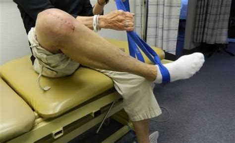 Recovering Total Knee Replacement Surgery Healing Rehab