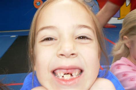 We did not find results for: Smith Family Adventures: The story of two front teeth