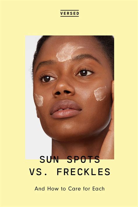 The Difference Between Sunspots And Freckles And How To Care For Each