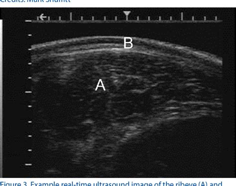 Figure 1 From Ultrasound And Carcass Merit Of Youth Market Cattle Semantic Scholar