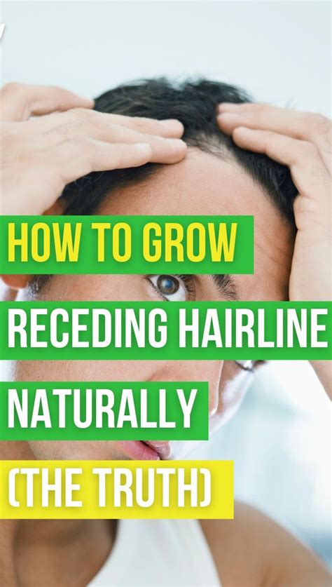 How To Grow Receding Hairline Naturally In 2021 Hairline Growing Truth