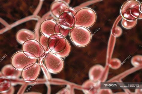 Digital Illustration Of Yeast And Hyphae Stages Of Candida Albicans