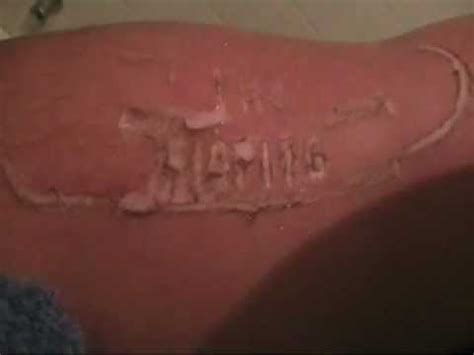 We did not find results for: hot branding on arm - YouTube