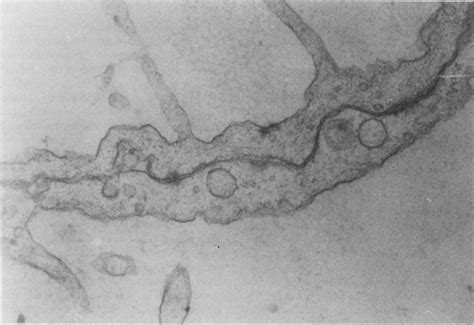 Transmission Electron Microscope Photograph Of The Wall Of One Vesicle