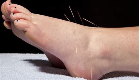 Maldron hotel (formerly bewleys) newlands cross, naas road, dublin 22. Beyond Podiatry - Myofascial Dry Needling