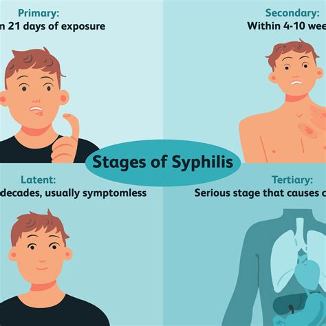There are three stages of syphilis, along with an inactive (latent) stage. Syphilis : Skin Specialist In Gurgaon Best Skin Care ...