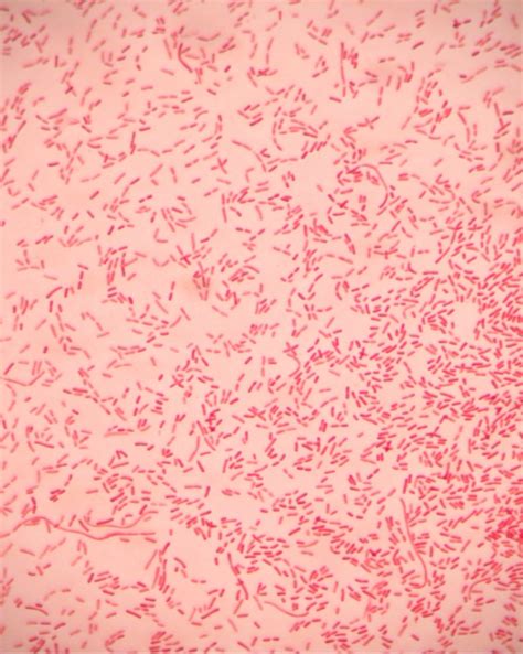 Gram Stain Red Mountain Microbiology