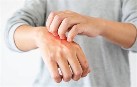 Home Remedies For Dry Skin Problems Ezilon Articles