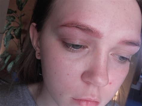 How To Treat Allergic Reaction To Eyebrow Tint