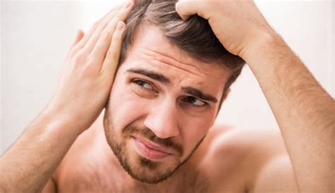 Whats The Truth Of Sudden Hair Loss In Men Addcolos Blog Dream