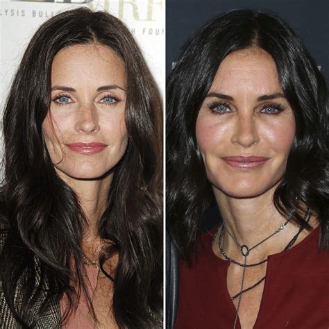 Plastic Surgery Before And After Pics Courteney Cox Jwoww And More