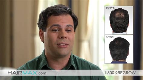 Leo Talks Hair Loss And Shares His Amazing Hairmax Hair Growth Success Story Youtube
