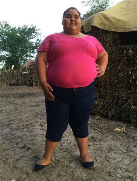 La Adolescente M S Obesa Del Mundo Baj Kilos Volv A Nacer